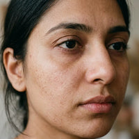 Dull & Uneven Skin